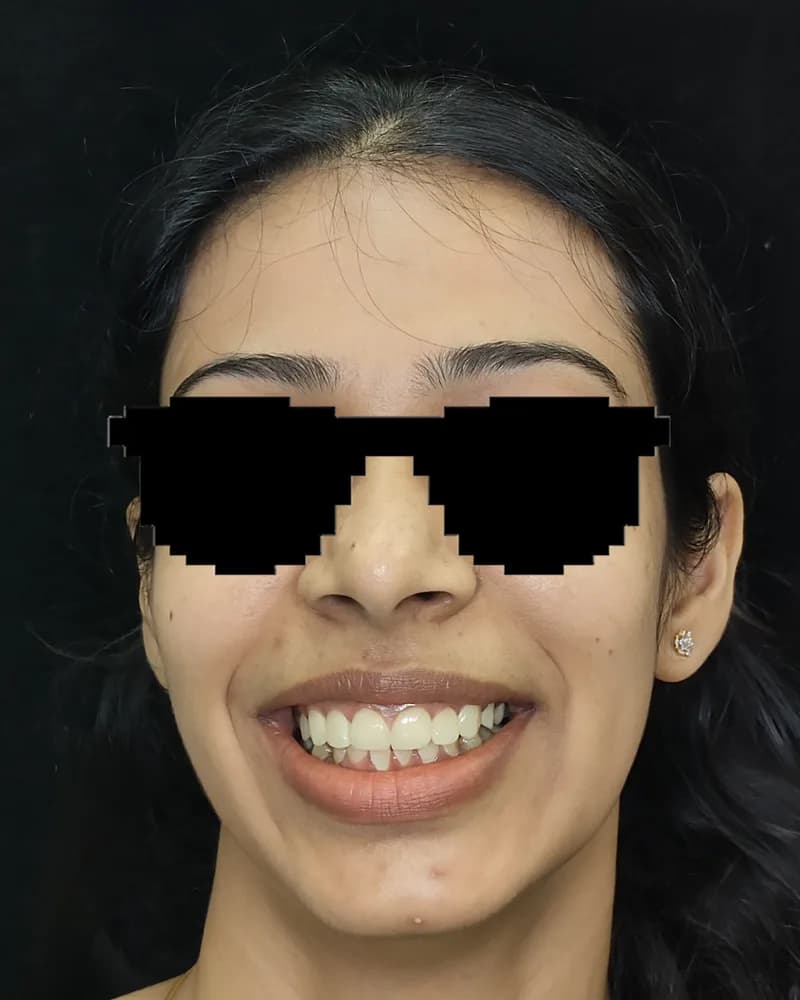 Case 03 after