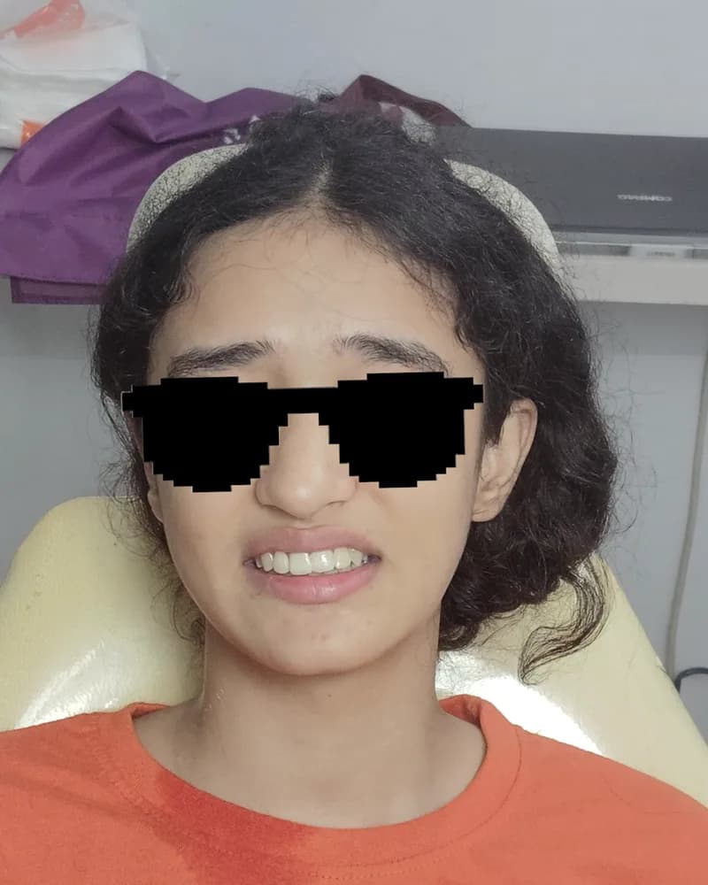 Case 04 after