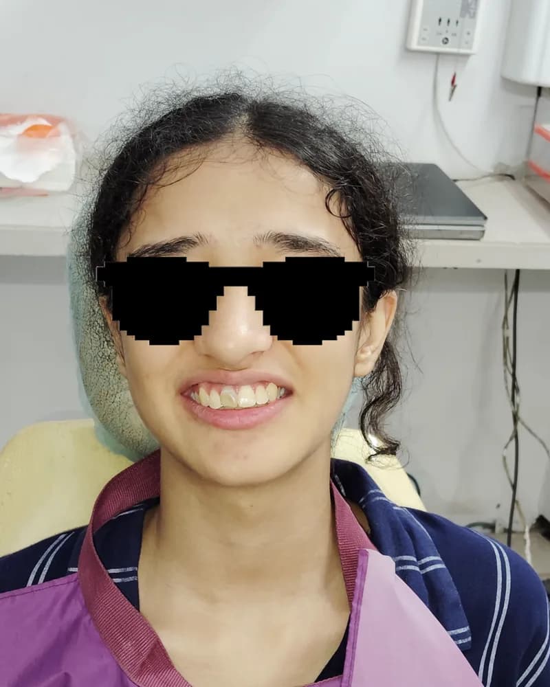 Case 04 before