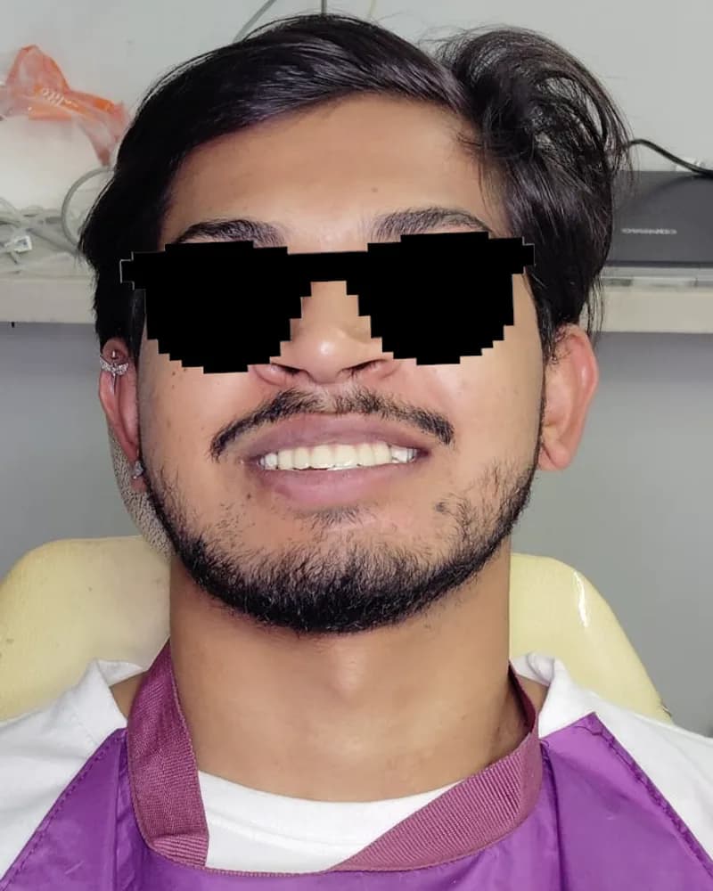 Case 05 after