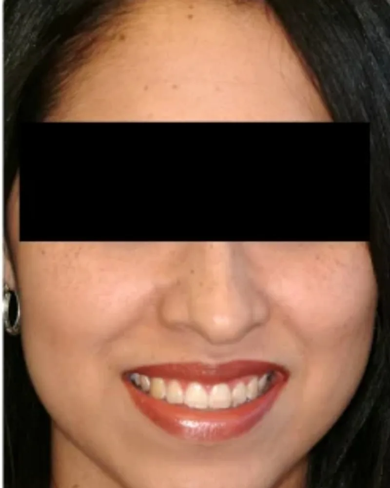 Case 06 after