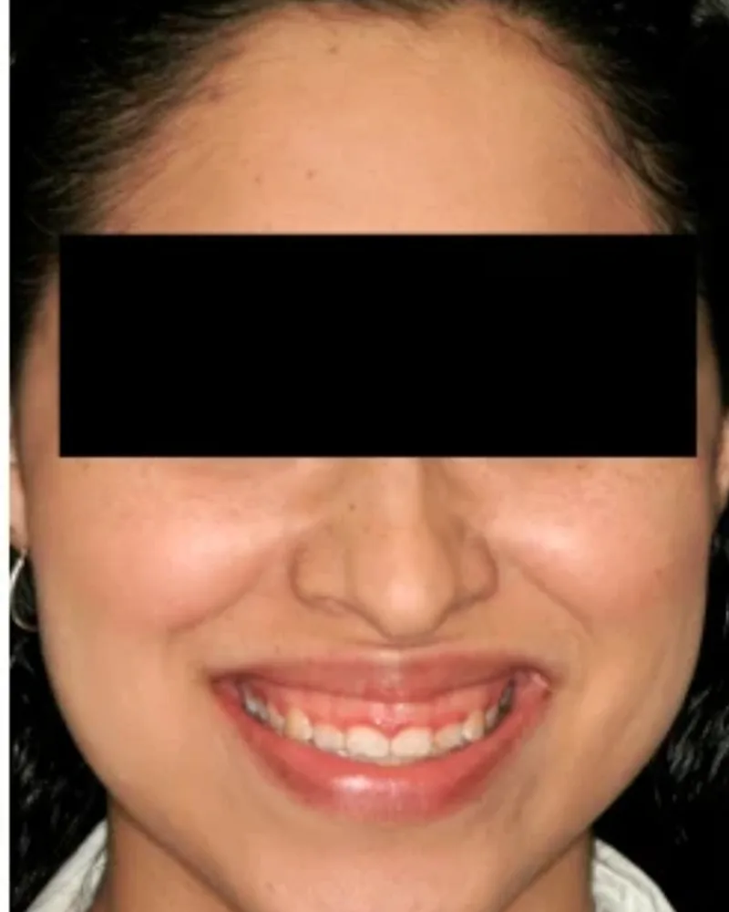 Case 06 before