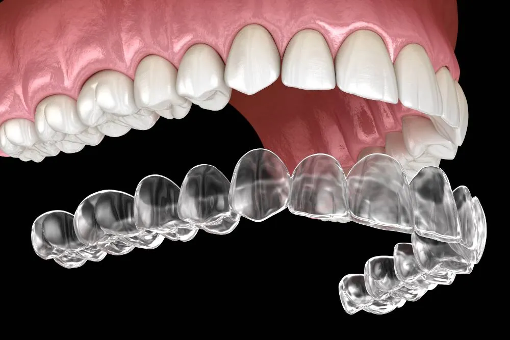 Braces & Clear Aligners