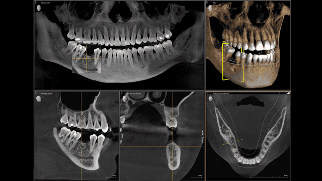 CBCT & OPG imaging in-house