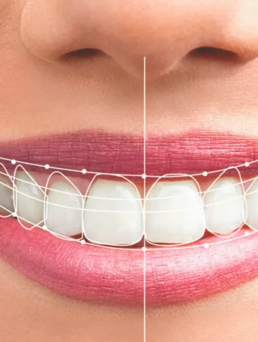 Digital smile design planning for cosmetic dentistry